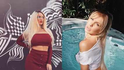 Vidéo Choc d'Aurélie et Adixia en pleine séance de botox