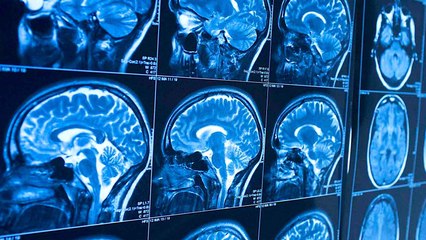 Cette étude dévoile comment sauver facilement son cerveau