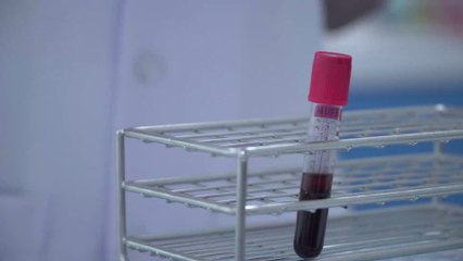 Coronavirus : Faut-il avoir peur de la contagion ? Une médecin nous éclaire