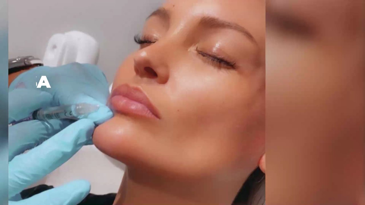 Aurélie Dotremont documente sa nouvelle opération esthétique