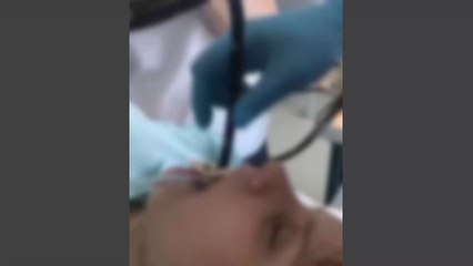 Des médecins retirent un serpent avalé par une femme