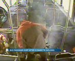 Bus passanger hurt after E-cigarette explodes