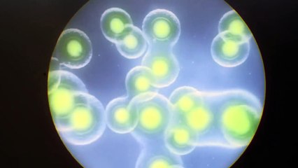 Cleverman - season 2 Tráiler VO