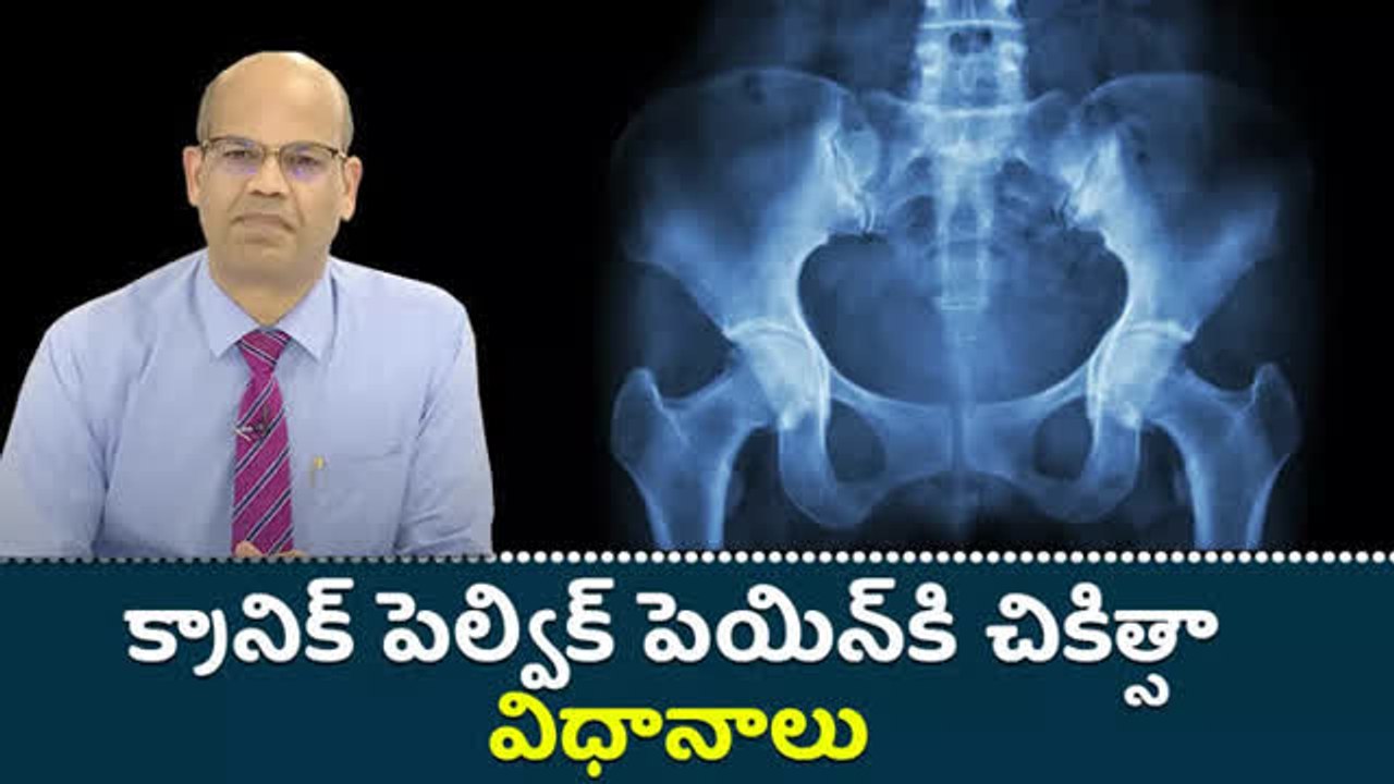 క్రానిక్ పెల్విక్ పెయిన్‌కి చికిత్సా విధానాలు