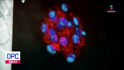 VPH: 8 de cada 10 mujeres con vida sexual activa contraen este virus