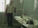 Indian woman attacked with acid by her alleged rapist