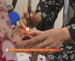 Rawatan rapi penyakit air mata darah elak risiko buta