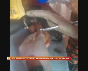 Jari telunjuk seorang kanak-kanak tersepit di spanar