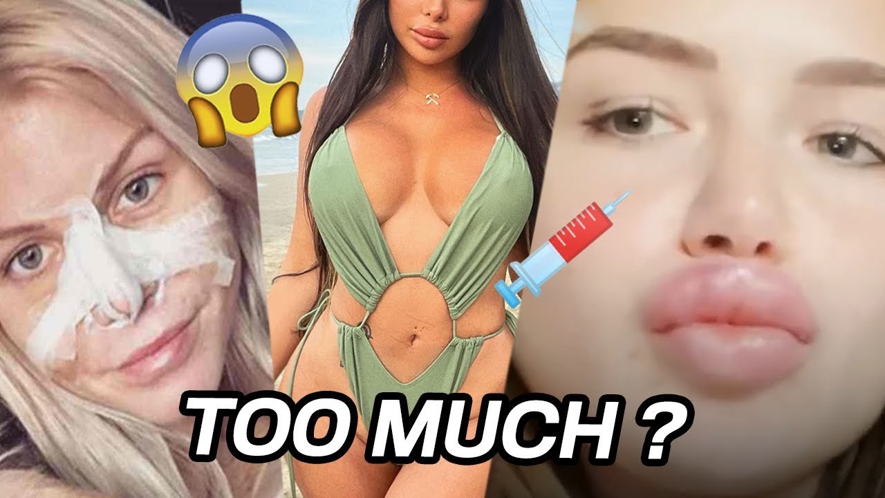 Ces candidates de télé-réalité qui regrettent leur chirurgie