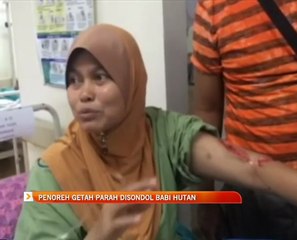 Penoreh getah parah disondol babi hutan