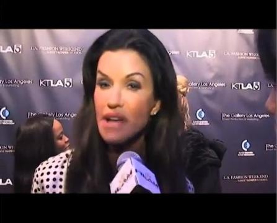 Janice Dickinson dedahkan hidap barah payudara