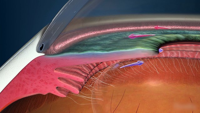 Las enfermedades oculares cada vez más frecuentes entre los españoles