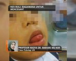 Kes buli: Bagaimana untuk mencegah?