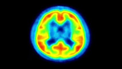 The Substance: Albert Hofmann&#039;s LSD Tráiler VO