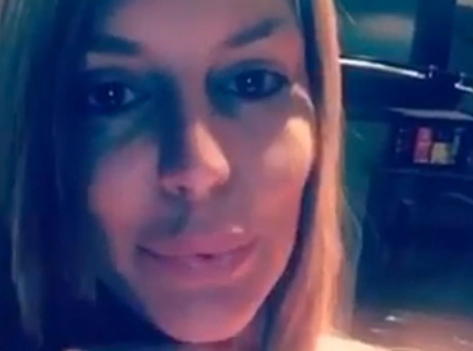 Mad Mag : Aymeric Bonnery soupçonne Amélie Neten d'avoir fait refaire ses pommettes !