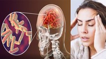 सिर में लगातार दर्द होना Brain Tuberculosis के Symptoms, क्या है कारण और जांच का तरीका  | Boldsky