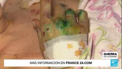 A lo largo y ancho de Ucrania los hospitales están saturados