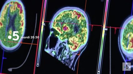Enquête de santé (france 5) Alzheimer comment lutter contre la maladie