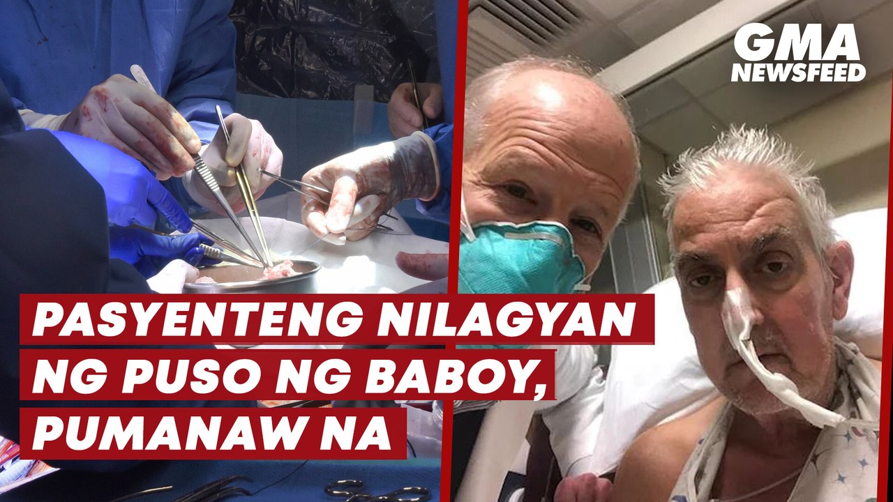 Pasyenteng nilagyan ng puso ng baboy, pumanaw na | GMA News Feed