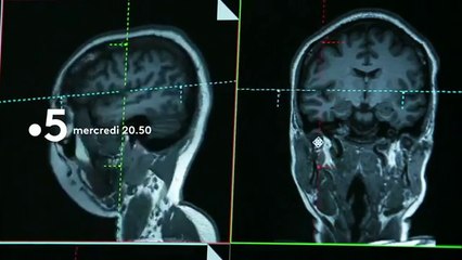 Enquête de santé - Sommes-nous tous bipolaires - france 5 - 07 02 18