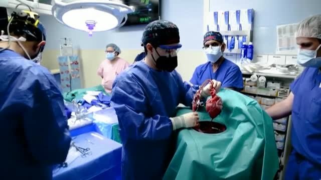 Fallece el hombre que recibió el corazón de un cerdo modificado genéticamente