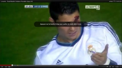 Vidéo Real Madrid : Le coup de coude sur l'arcade de Cristiano Ronaldo