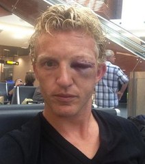 Insolite : Pourquoi Dirk Kuyt a été totalement défiguré