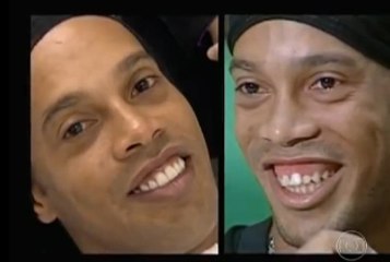 Insolite : Les nouvelles dents de Ronaldinho