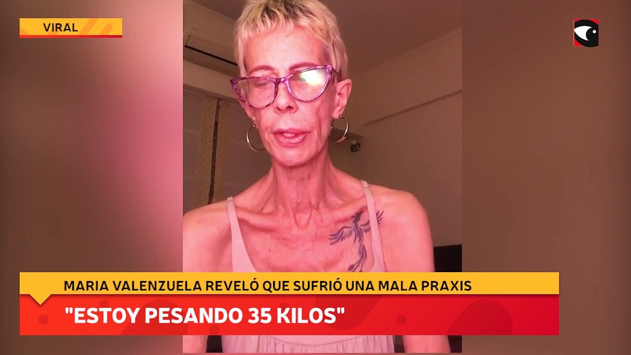 "Estoy pesando 35 kilos"