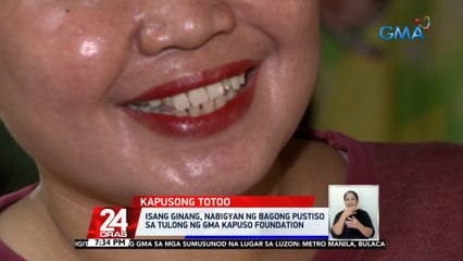 Isang ginang, nabigyan ng bagong pustiso sa tulong ng GMA Kapuso Foundation | 24 Oras