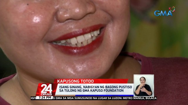 Isang ginang, nabigyan ng bagong pustiso sa tulong ng GMA Kapuso Foundation | 24 Oras
