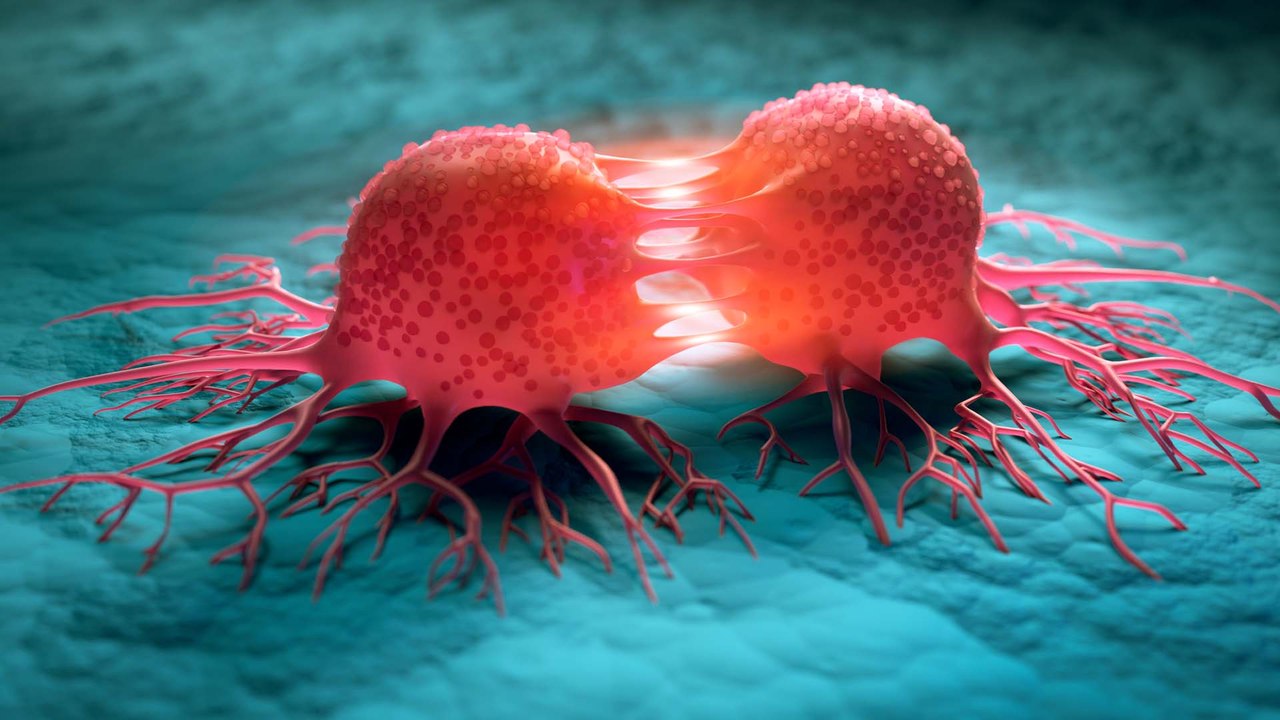Krebsforschung: Können Cholesterinsenker bald gegen Tumore helfen?