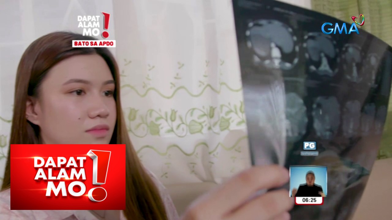 Dapat Alam Mo!: Pagkakaroon ng gallstones, paano maiiwasan?