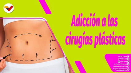 Buena Vibra | Tema del día: ¿Adicciones a las cirugías estéticas?
