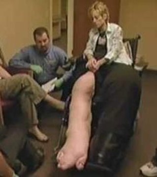 Elle a vécu avec des jambes de 63 kilos