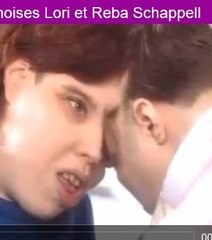 Lori et George, siamois depuis 50 ans