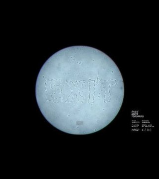 Un logiciel permet de faire danser les spermatozoïdes