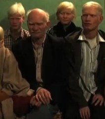 Une famille albinos veut entrer dans le livre des Records