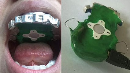 Un lecteur MP3 qui se place dans la bouche !