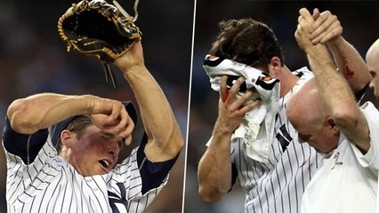 Baseball : Bryan Mitchell se prend la balle à 155 km/h en plein visage