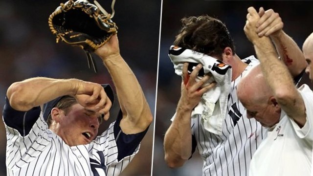 Baseball : Bryan Mitchell se prend la balle à 155 km/h en plein visage