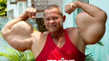 Arlindo de Souza, alias Popeye, souhaite avoir les plus gros biceps du monde, mais à quel prix ?