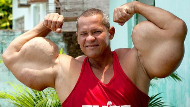 Arlindo de Souza, alias Popeye, souhaite avoir les plus gros biceps du monde, mais à quel prix ?