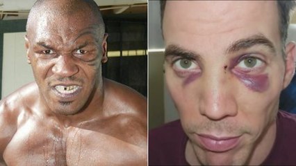 Mike Tyson : L'ancien boxeur casse le nez de Steve-O de Jackass en direct