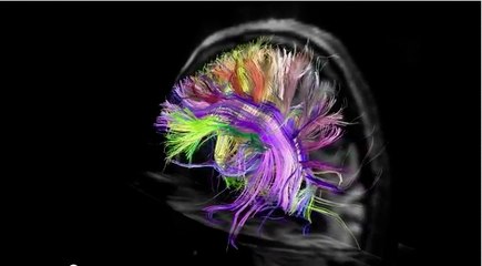 Voilà à quoi ressemble vos neurones