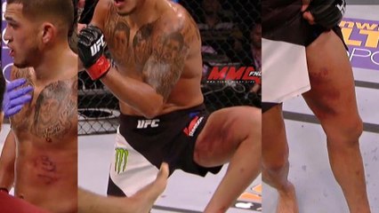 UFC 197 : Edson Barboza blesse sévèrement Anthony Pettis