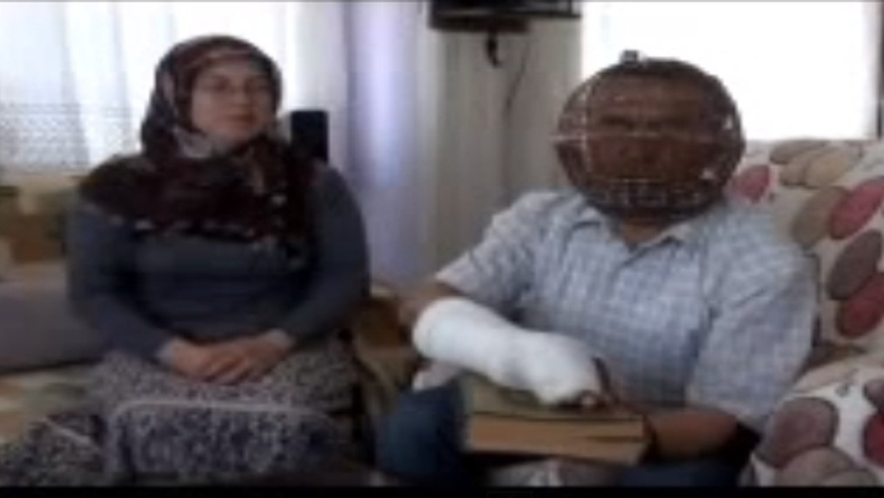 Pour arrêter de fumer, Ibrahim Yücel porte un masque d'acier !