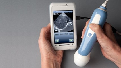 MobiUS : ce scanner à ultrasons portables se connecte à votre smartphone !