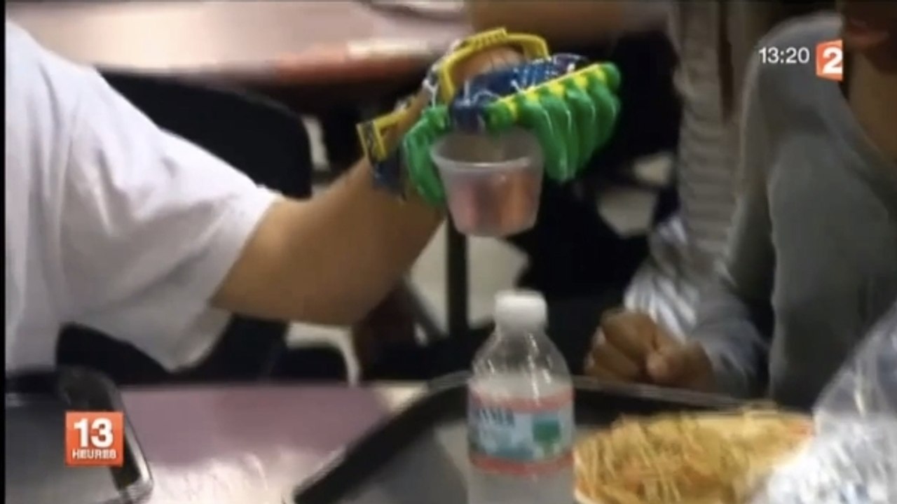 Sans doigts depuis sa naissance, Leon McCarthy, 11 ans, retrouve sa main grâce à l'impression 3D