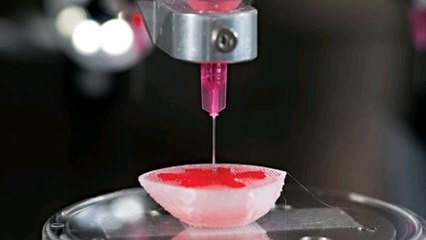 L'impression 3D : la technologie qui va révolutionner la médecine